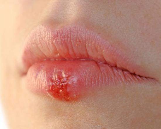 Перманентный макияж контура губ: как проходит процедура и что получается в результате